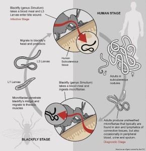 The life cycle of Onchocerca volvulus, a parasitic worm which causes river blindness. 